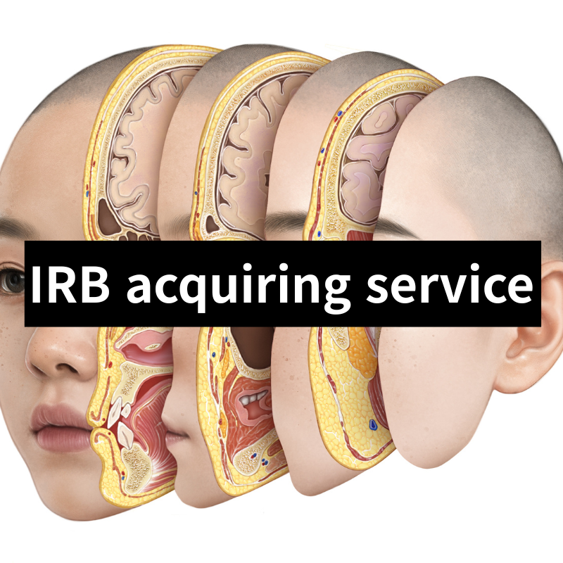 IRB acquiring service